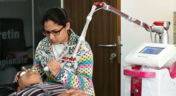 Fractional CO2 Laser Treatment